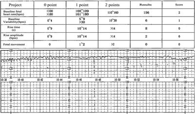 Case Report: Fetomaternal hemorrhage and its association with pronounced neonatal anemia